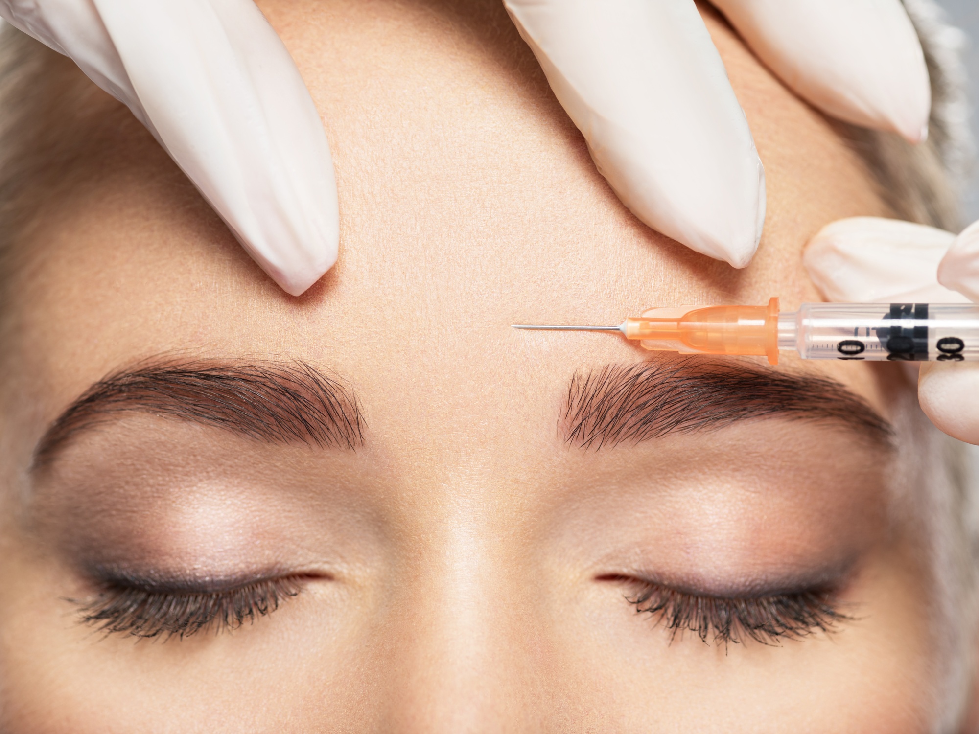 Woman getting cosmetic injection of botox near eyes - Beauty-lush-medspa