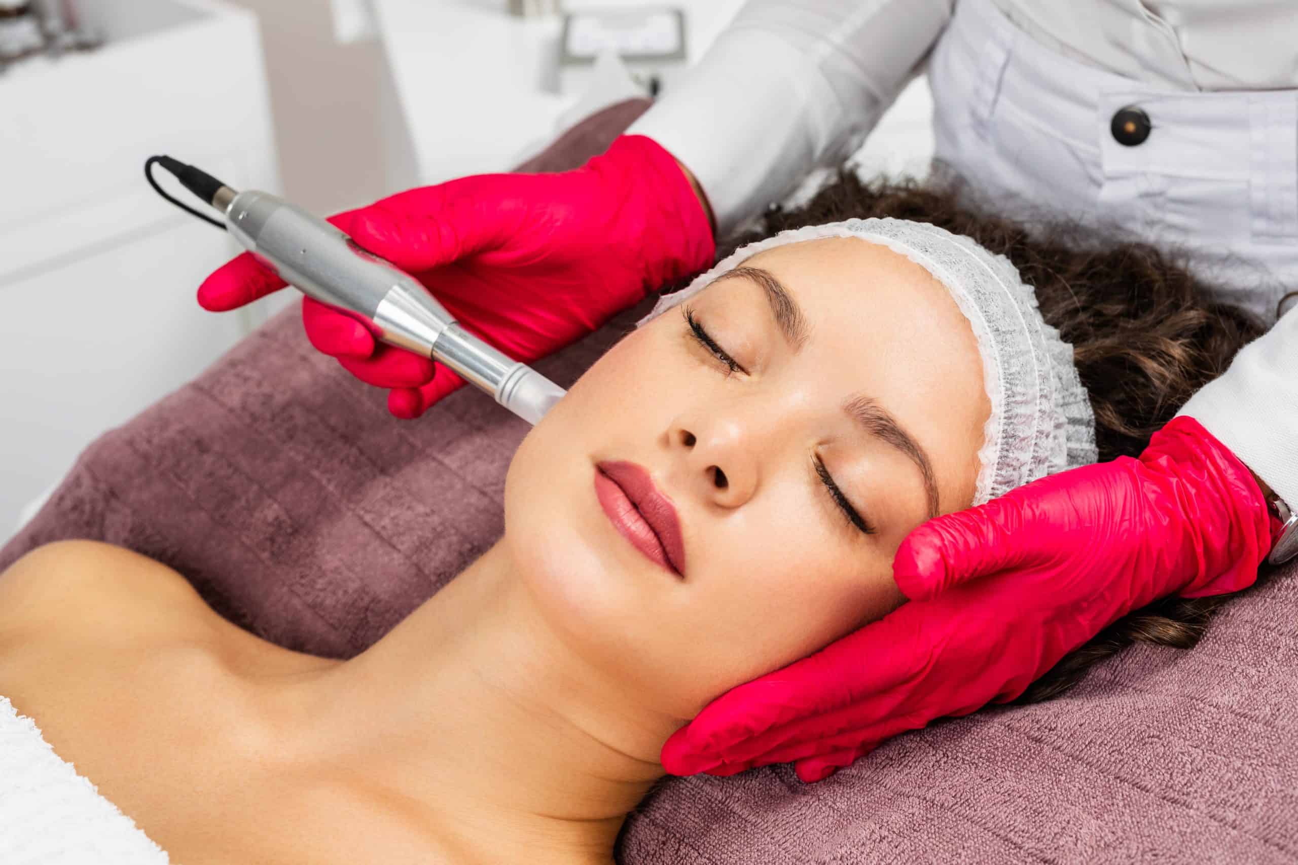Blog 6 Microneedling min scaled